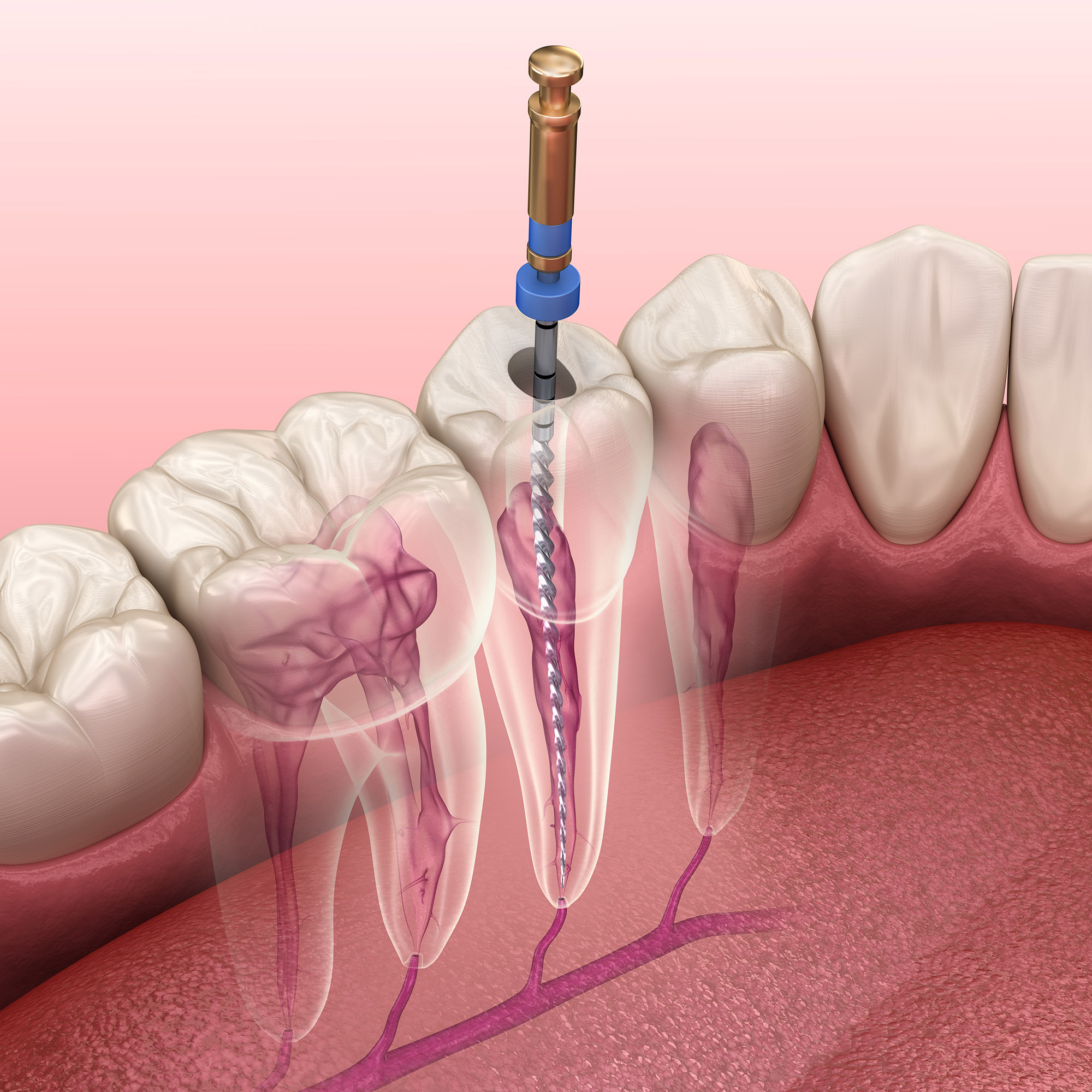 Slider Image 1