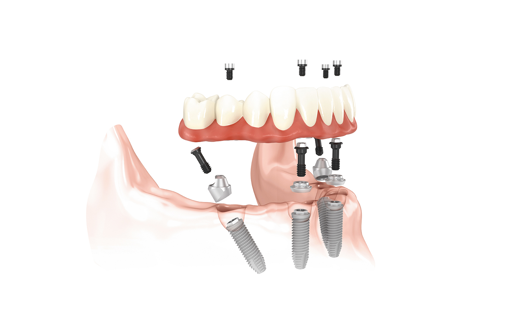 Slider Image 5