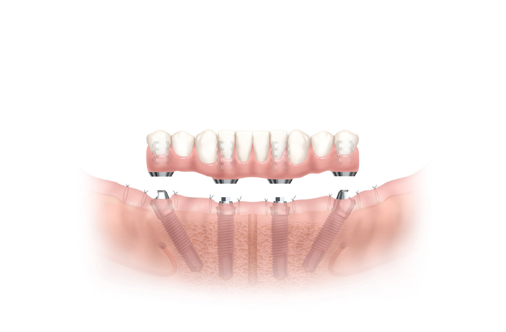 Slider Image 7